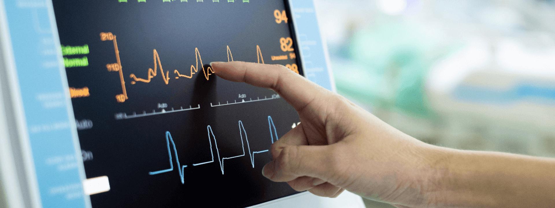 EKG